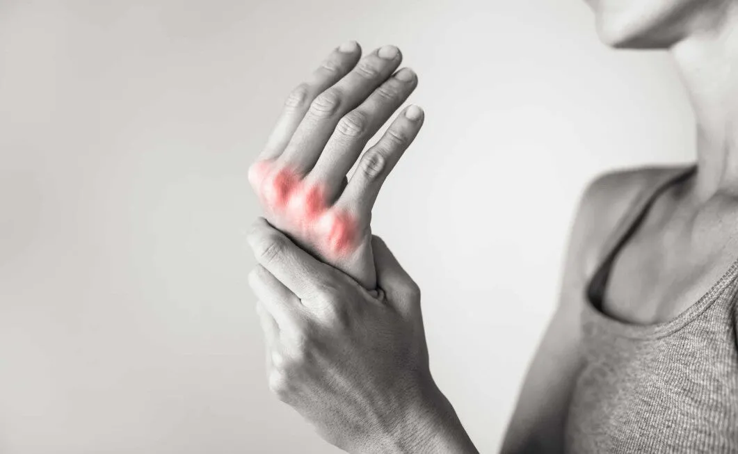 Scopri di più sull'articolo Come il CBD può aiutare nell’artrite
